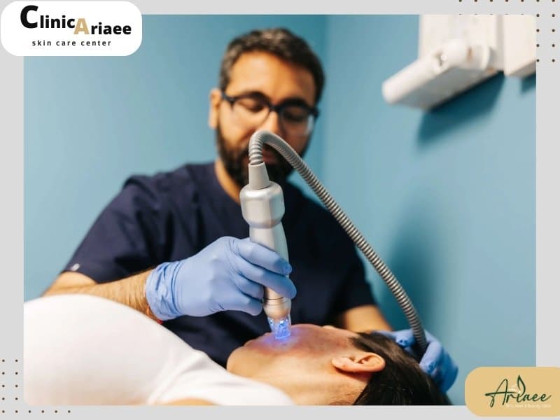 سوالات متداول درباره لیزر اسکارلت