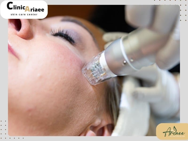 اسکارلت چگونه باعث جوانسازی پوست میشود؟