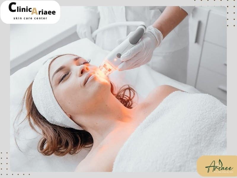 کاربردهای لیزر اسکارلت در جوانسازی و ترمیم پوست