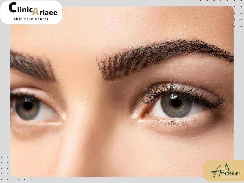 جدول مقایسه روشهای مختلف کاشت ابرو