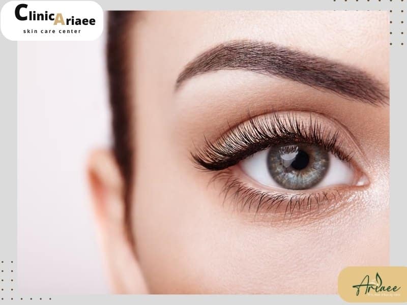 مقایسه کاشت مژه با موی بلند بدون جراحی با سایر روش‌های کاشت ابرو
