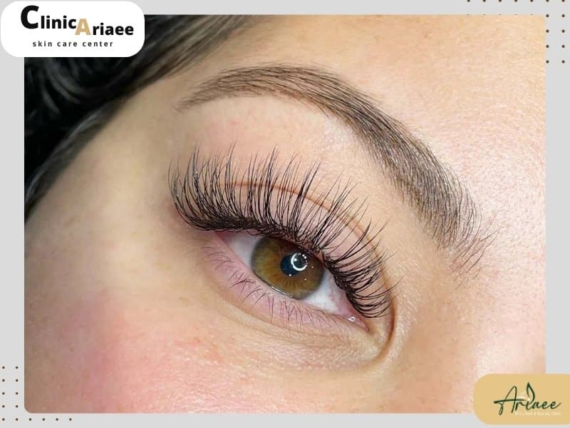 نکات مهم بعد از کاشت مژه با موی بلند بدون حراحی