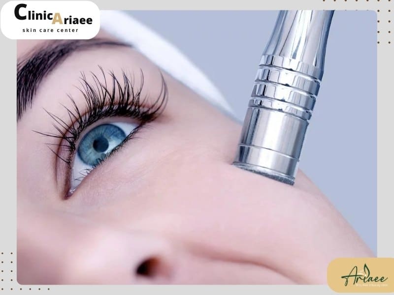 نحوه پاکسازی پوست با میکرودرم