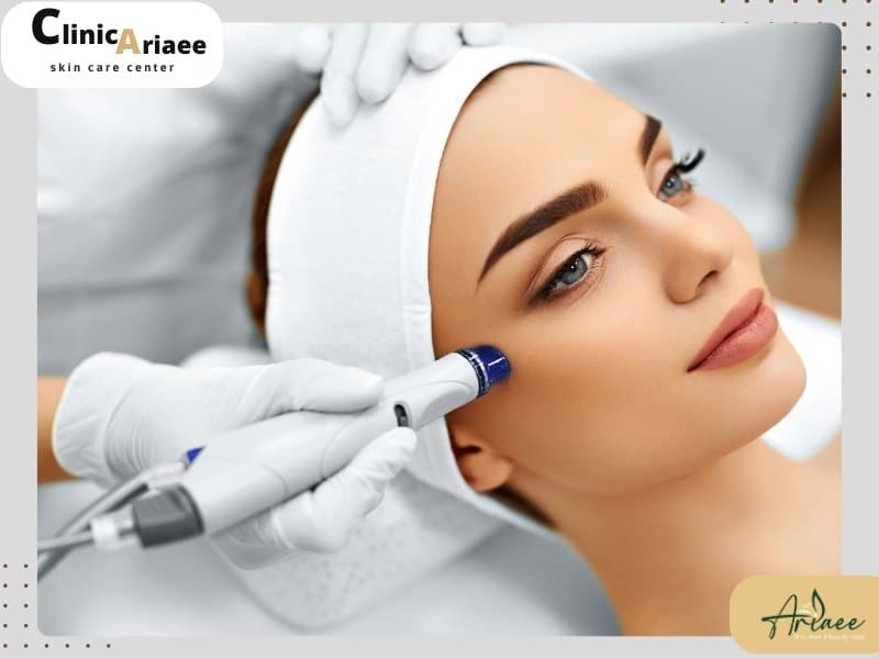 مراقبت های قبل و بعد از میکرو درم ابریژن