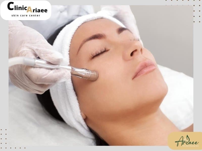 کاربرد میکرودرم صورت (فواید میکرودرم ابریژن)