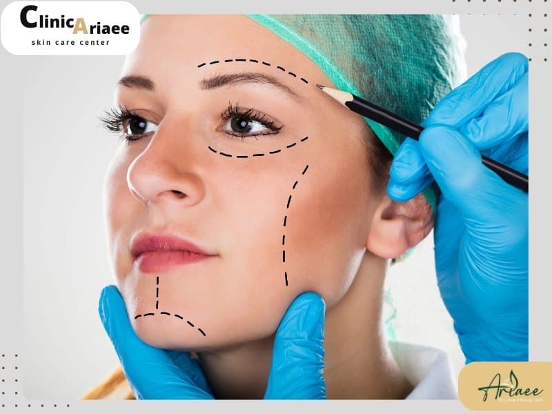 چگونه تزریق چربی به بازیابی حجم و کانتورینگ صورت کمک می کند؟