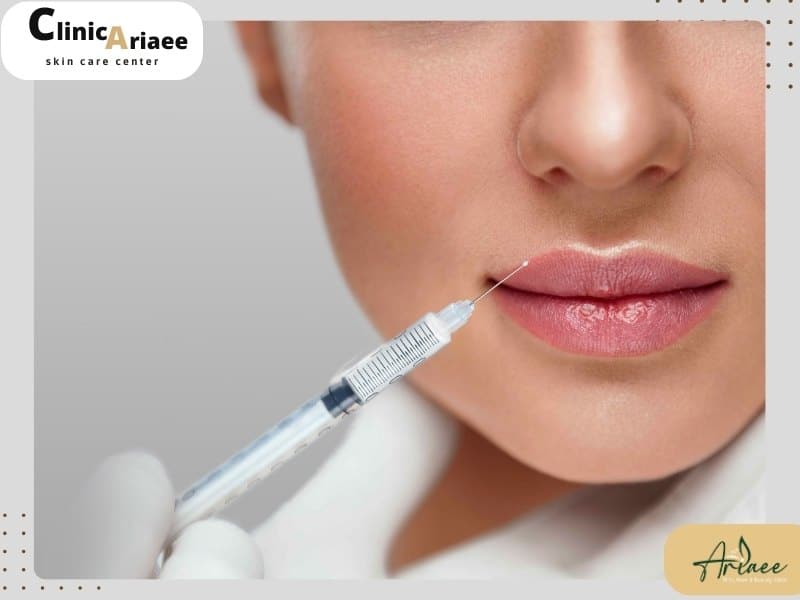تفاوت ژل‌های تزریق برای گونه و لب