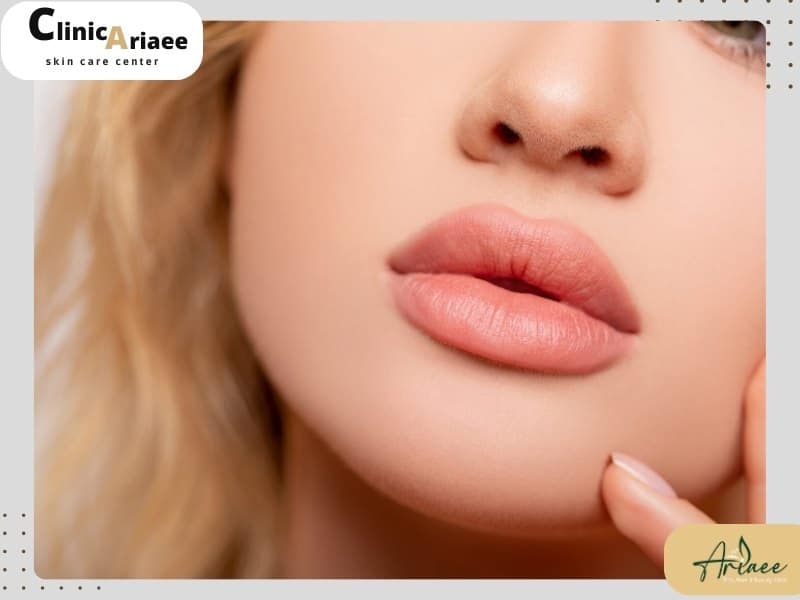 نکات مهم برای تزریق ژل لب در بهترین کلینیک گیشا
