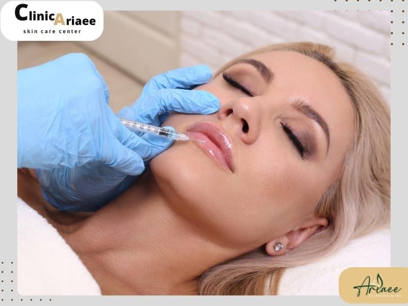 تزریق ژل لب؛ فقط یک زیباسازی نیست!