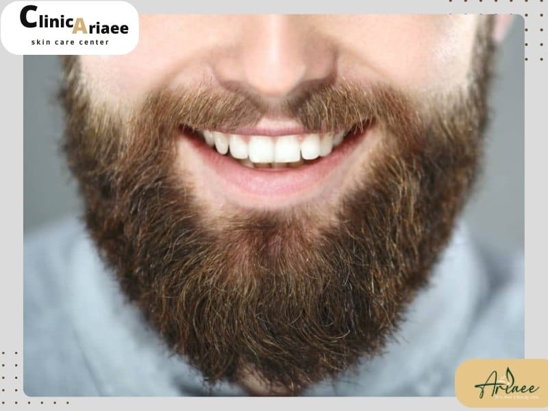 مراقبتهای بعد از کاشت ریش و سبیل برای داشتن نتایج بهتر