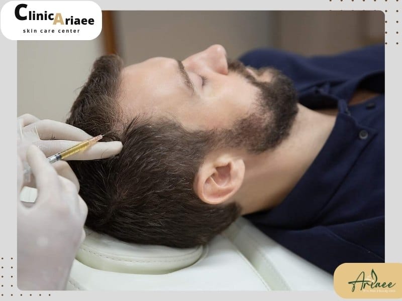 مزایای مزوتراپی مو در ونک