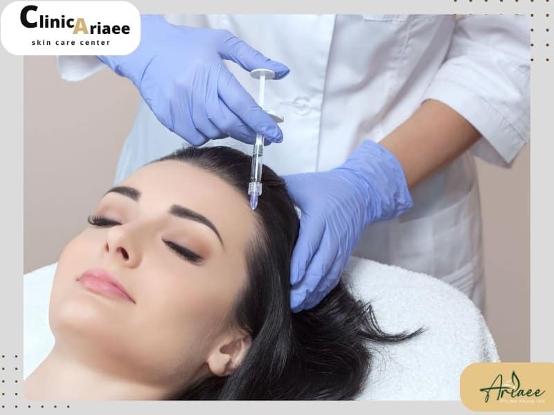 هزینه مزوتراپی مو در ونک در سال 1404