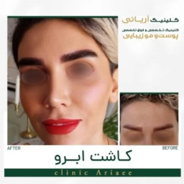 نمونه-کار-کاشت-ابرو-1 (1)