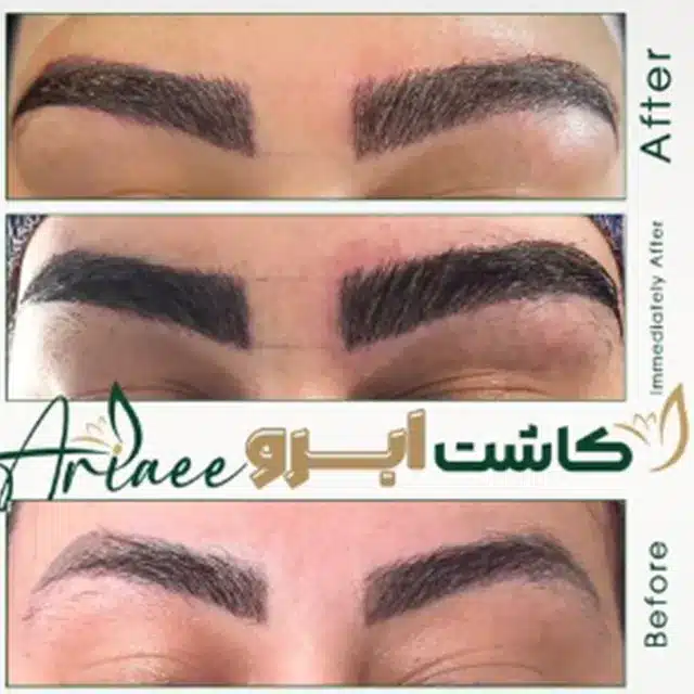 نمونه-کار-کاشت-ابرو (1)