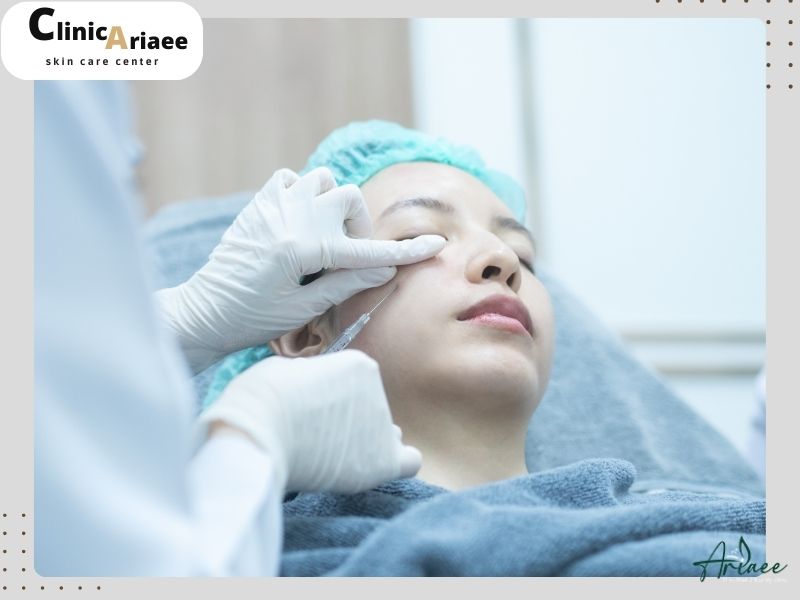 Mesogel under the eyes