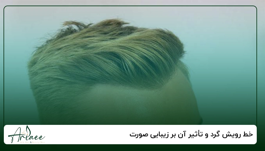 خط رویش گرد و تأثیر آن بر زیبایی صورت