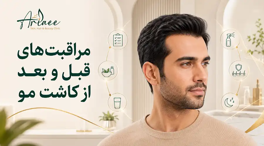 مراقبت‌های قبل و بعد از کاشت مو