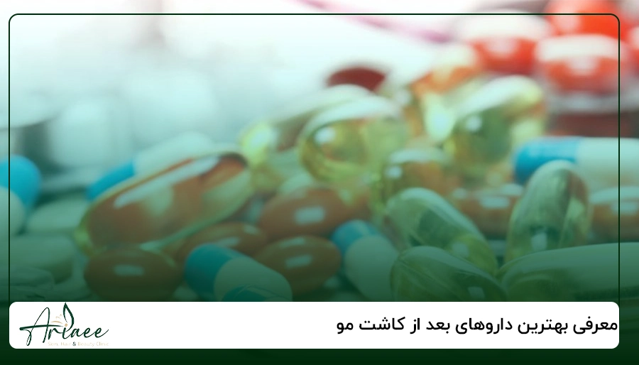 معرفی بهترین داروهای بعد از کاشت مو