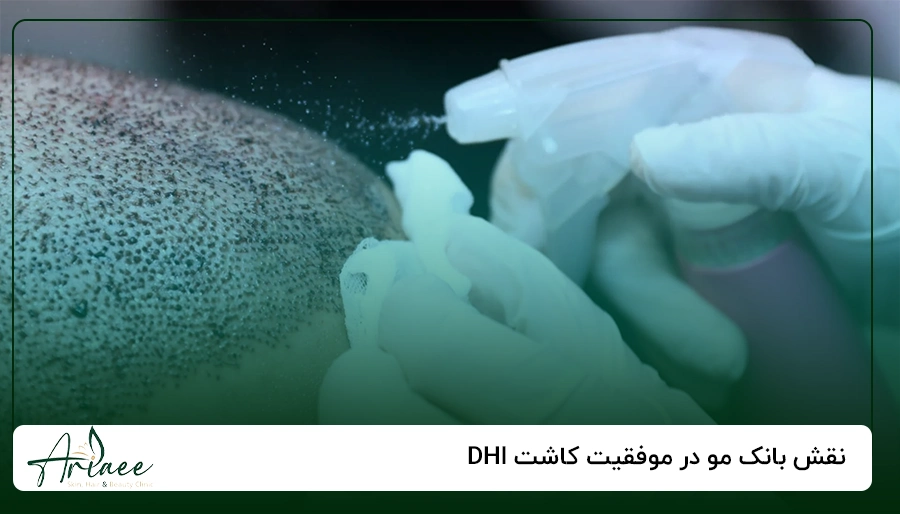 نقش بانک مو در موفقیت کاشت DHI