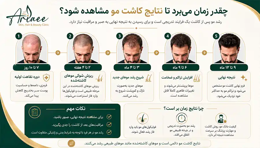 چقدر زمان می‌برد تا نتایج کاشت مو مشاهده شود؟