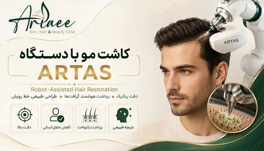 کاشت مو با دستگاه ARTAS (Robot-Assisted Hair Restoration)