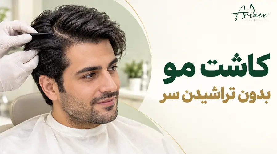کاشت مو بدون تراشیدن سر