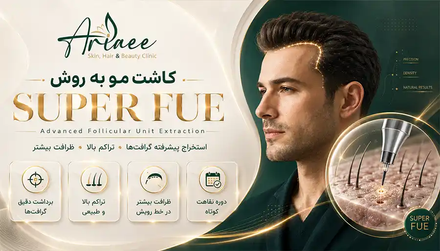 کاشت مو به روش super fue