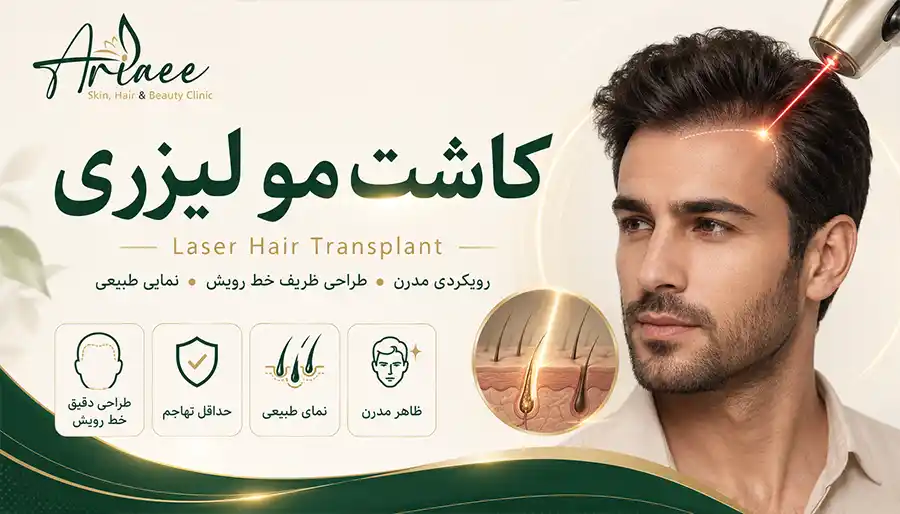 کاشت مو لیزری