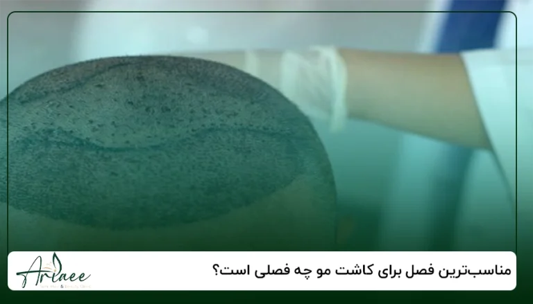 مناسب_ترین فصل برای کاشت مو چه فصلی است؟