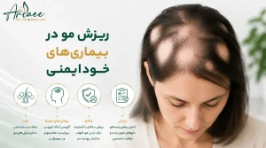 بررسی تخصصی ریزش مو در بیماری های خودایمنی