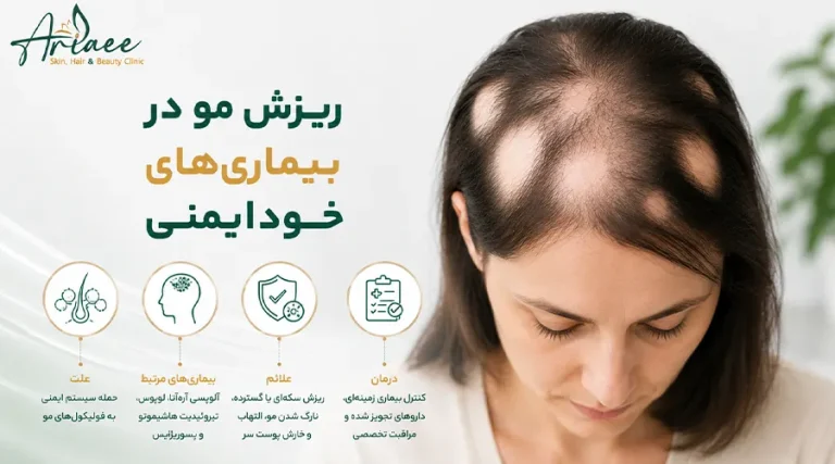 بررسی تخصصی ریزش مو در بیماری های خودایمنی