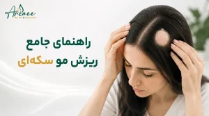 راهنمای جامع ریزش مو سکه‌ای