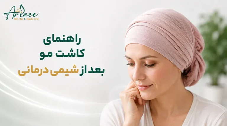 راهنمای کاشت مو بعد از شیمی درمانی