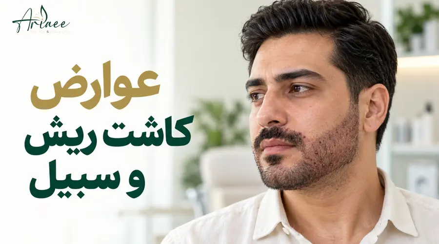 عوارض کاشت ریش و سبیل