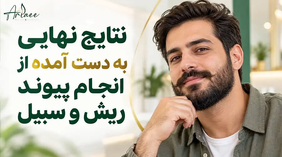 نتایج نهایی به دست آمده از انجام پیوند ریش و سبیل