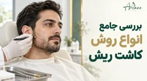 بررسی جامع انواع روش کاشت ریش