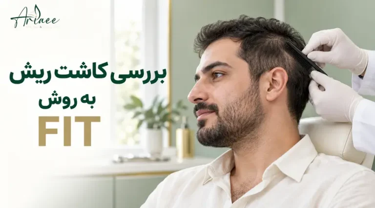 بررسی کاشت ریش به روش FIT