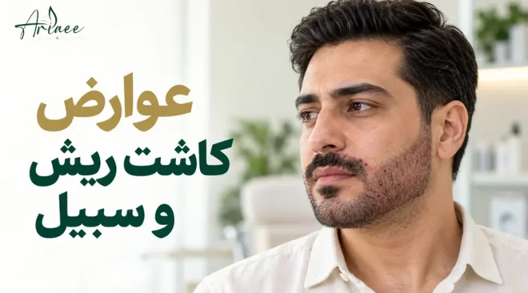 عوارض کاشت ریش و سبیل