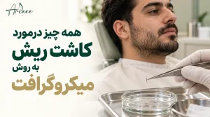 همه چیز درمورد کاشت ریش به روش میکروگرافت