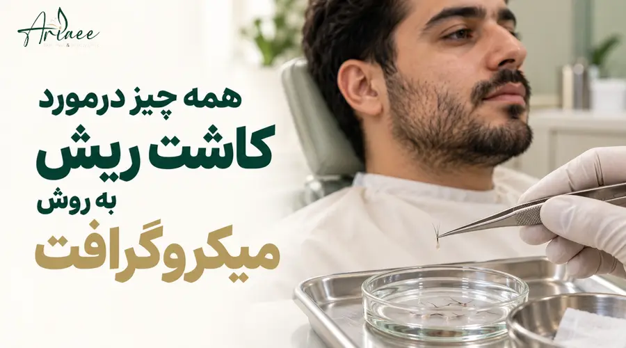 همه چیز درمورد کاشت ریش به روش میکروگرافت