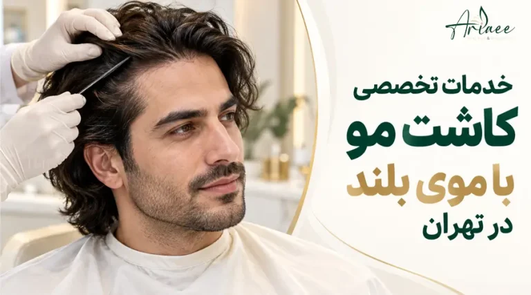 خدمات تخصصی کاشت مو با موی بلند در تهران